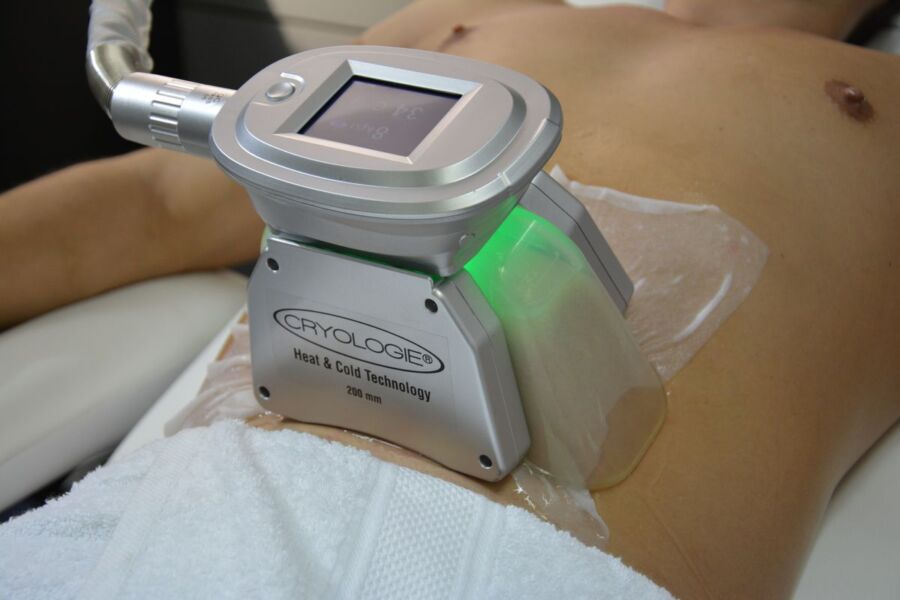 Soin minceur cryolipolyse résultat