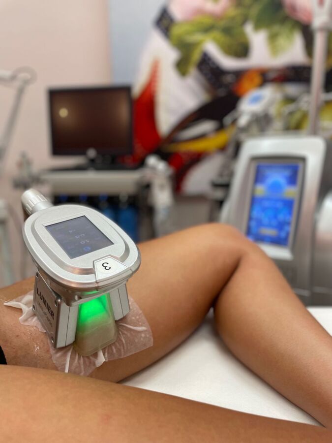 Soin minceur cryolipolyse résultat