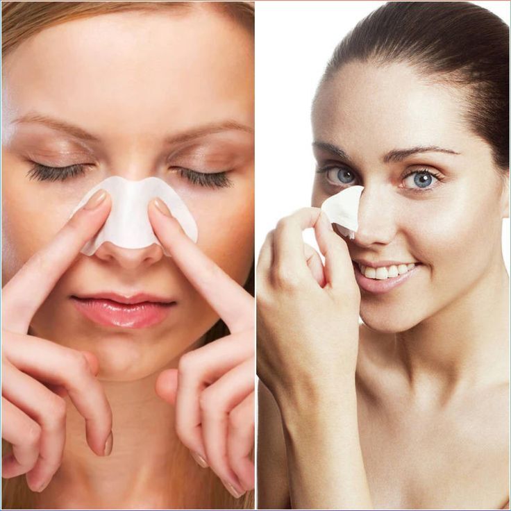 extraction points noirs cannes