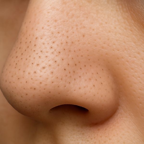 Soin visage extraction comédons professionnel